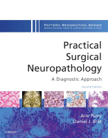 Practical Surgical Neuropathology: A Diagnostic Approach