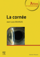 La Cornée