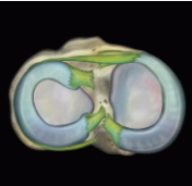MRIonline Mri mastery series knee 2021 cme videos