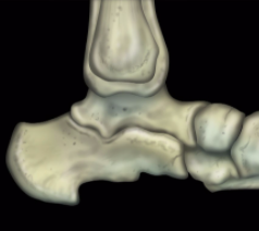 MRIonline Mri mastery series Ankle 2017 cme videos