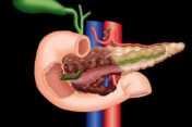 mrionline-imaging-mastery-series-pancreas-imaging-2021
