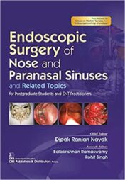 Endoscopic Surgery of Nose and Paranasal Sinuses and Related Topics: For Postgraduate Students and ENT Practitioners