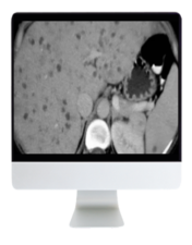 ARRS State of the Art Liver Imaging in Cirrhosis 2021