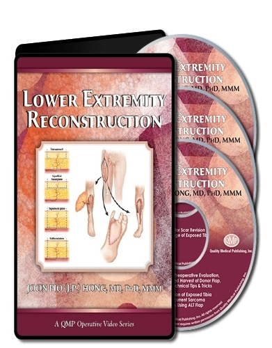 Lower Extremity Reconstruction CME VIDEOS