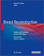 Breast Reconstruction: Modern and Promising Surgical Techniques 1st ed. 2020 Ed Original pdf+Video
