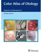 Color Atlas of Otology: Diagnosis and Management presents brilliant photographs of different otological disorders.