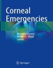 Advanced corneal ectasias