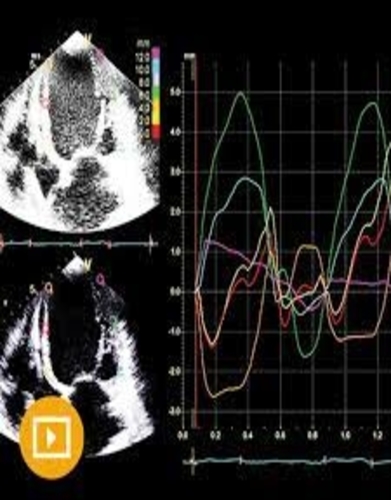 Echocardiography – A Comprehensive Review 2022 cme videos