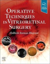 Operative Techniques in Vitreoretinal Surgery 2022 True PDF