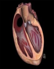 Cardiology