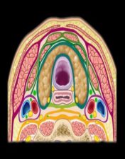 MRIOnline Mastery Series: The Carotid Space 2021