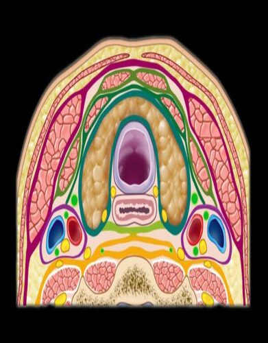 MRIOnline Mastery Series: The Carotid Space 2021