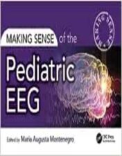 Making Sense of the Pediatric EEG , 2023 Original PDF