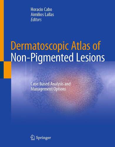 Dermatoscopic Atlas of Non-Pigmented Lesions (Original PDF