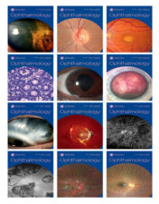 Ophthalmology 2023 Full Archives True PDF