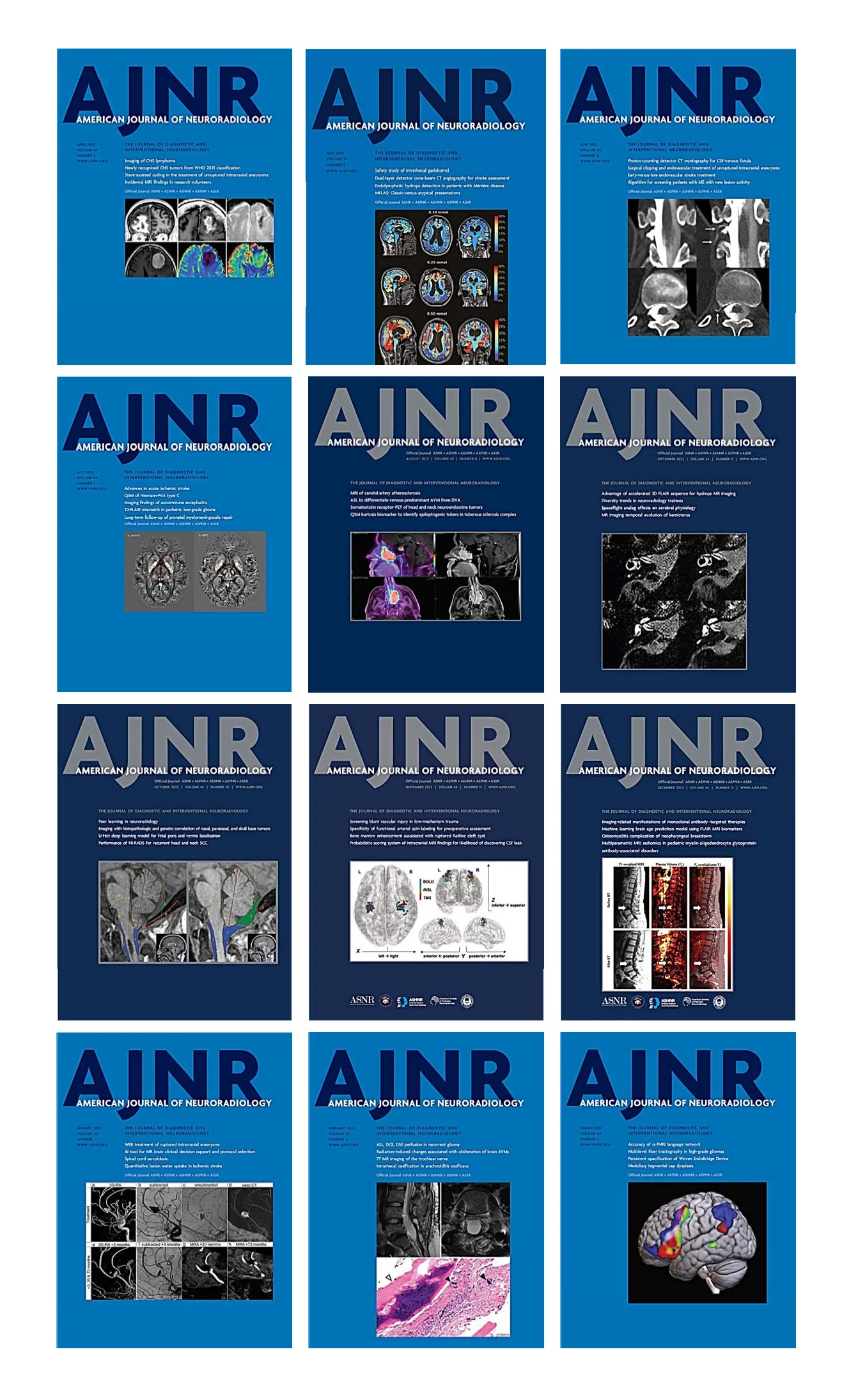 American-journal-of-Neuroradiology-2023 (1)