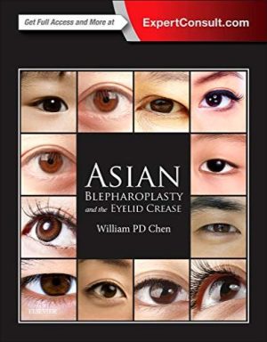 https://www.amazon.com/Asian-Blepharoplasty-Eyelid-Crease-William/dp/0323355722