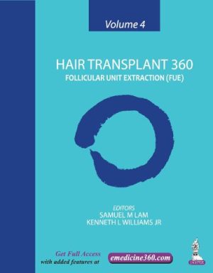 Hair Transplant 360: Volume 4: Follicular Unit Extraction 2016 - PDF+VIDEOS (5.97Gb)