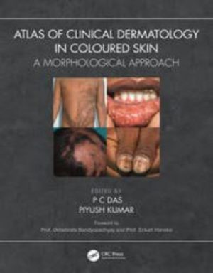 Atlas of Clinical Dermatology in Coloured Skin Original PDF 2023