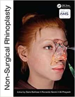 Non-Surgical Rhinoplasty (The PRIME Series) Original PDF 2023