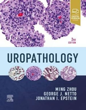 Uropathology, 2nd Edition ,2024 EPUB and converted pdf