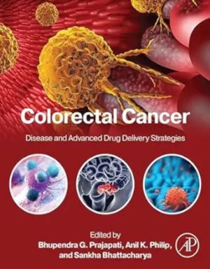 Colorectal Cancer: Disease And Advanced Drug Delivery Strategies, 12-Month Access,2023 Original PDF