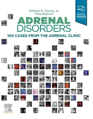 Adrenal Disorders: Cases From The Adrenal Clinic