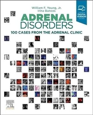Adrenal Disorders: 100 Cases From The Adrenal Clinic , 2022 Original PDF