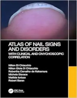Atlas Of Nail Signs And Disorders With Clinical And Onychoscopic Correlation ,2024 EPUB+converted pdf