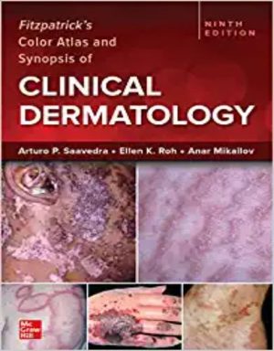 Fitzpatrick’s Color Atlas And Synopsis Of Clinical Dermatology, 9th Edition Original PDF