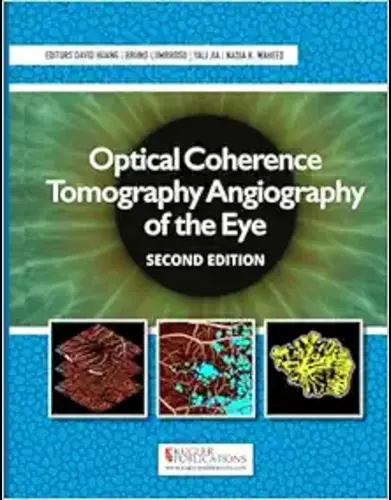 Optical Coherence Tomography Angiography Of The Eye, 2nd Edition,2023 EPub