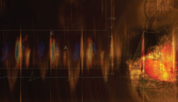 Mayo Clinic Echocardiography Online Board Review, 2021 Videos + Audios + Slides + Assessment