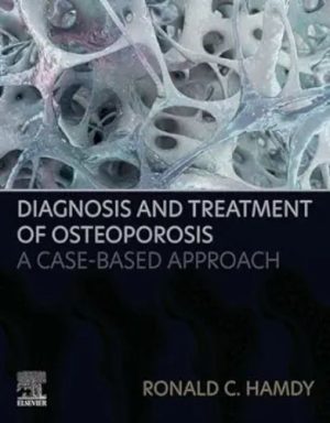 Diagnosis And Treatment Of Osteoporosis: A Case-Based Approach ,2024 EPUB