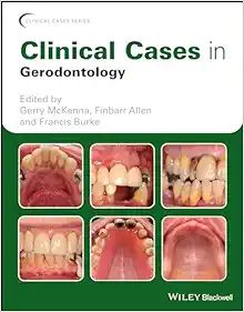 Clinical Cases In Gerodontology (Clinical Cases (Dentistry)) ,2019 Original PDF