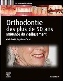 Orthodontie Des Plus De 50 Ans: Influence Du Vieillissement,2023 True PDF