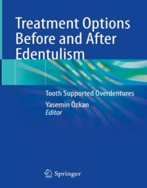 Treatment Options Before and After Edentulism, 2023 Original PDF