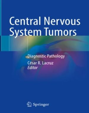 Central Nervous System Tumors, 2023 Original PDF