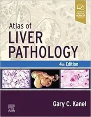 Atlas Of Liver Pathology, 4th Edition (True PDF