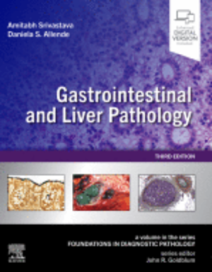 Gastrointestinal and Liver Pathology A Volume in the Series: Foundations in Diagnostic Pathology A volume in Foundations in Diagnostic Pathology