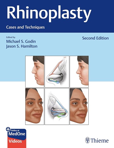 Rhinoplasty: Cases and Techniques 2nd Edition