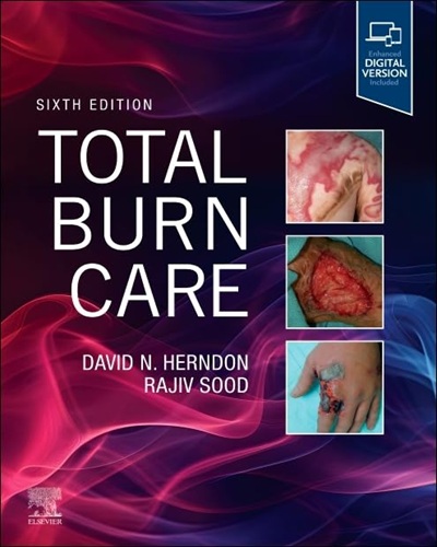 Total Burn Care 6th Edition